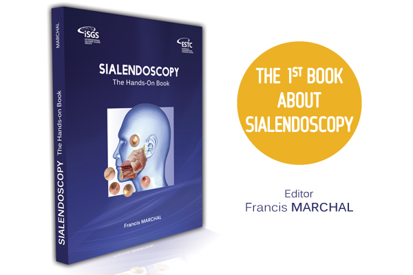 sialendoscopy hands-on book